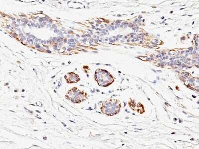 Immunohistochemistry-Paraffin: Myosin heavy chain 11 Antibody (MYH11/923) [NBP2-44533]
