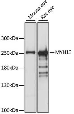 Western Blot: Myosin heavy chain 13 AntibodyAzide and BSA Free [NBP3-05614]