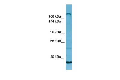 Western Blot: Myosin heavy chain 13 Antibody [NBP3-09481]