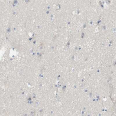 Immunohistochemistry-Paraffin: Myosin light chain 3 Antibody [NBP1-88068]
