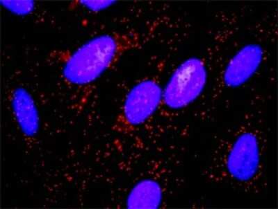 Proximity Ligation Assay: Myosin light chain kinase Antibody [H00004638-D01P]