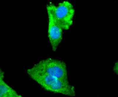 Immunocytochemistry/ Immunofluorescence: Myosin light chain kinase Antibody (SU40-06) [NBP2-67486]