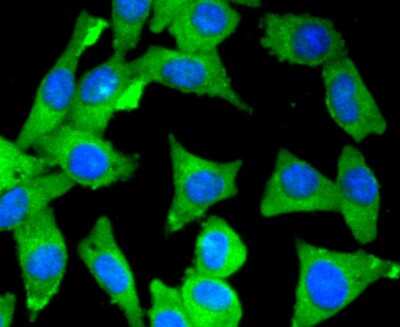 Immunocytochemistry/ Immunofluorescence: Myosin light chain kinase Antibody (SU40-06) [NBP2-67486]