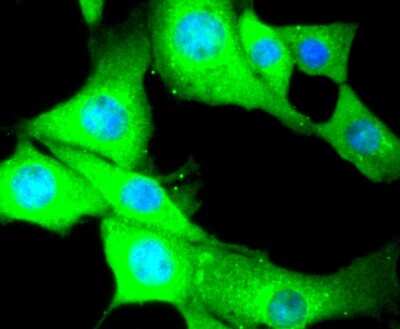 Immunocytochemistry/ Immunofluorescence: Myosin light chain kinase Antibody (SU40-06) [NBP2-67486]