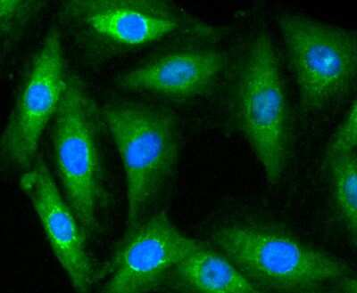 Immunocytochemistry/ Immunofluorescence: Myosin light chain kinase Antibody (SU40-06) [NBP2-67486]