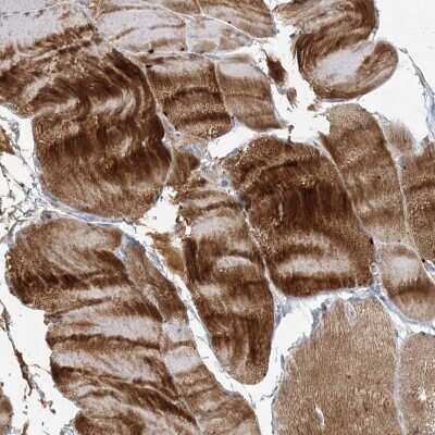 Immunohistochemistry-Paraffin: Myotilin Antibody [NBP2-38361]