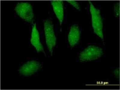 Immunocytochemistry/ Immunofluorescence: Myotrophin Antibody (1F3) [H00136319-M14]