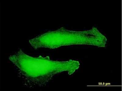 Immunocytochemistry/ Immunofluorescence: Myotrophin Antibody [H00136319-B03P]