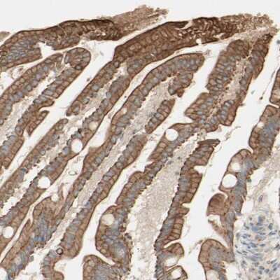 Immunohistochemistry-Paraffin: Myotubularin Antibody [NBP1-86107]