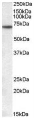 Western Blot: Myotubularin Antibody [NB300-949]