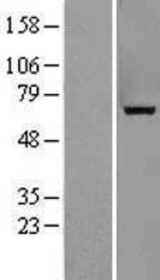 Western Blot: Myotubularin Overexpression Lysate [NBL1-13369]