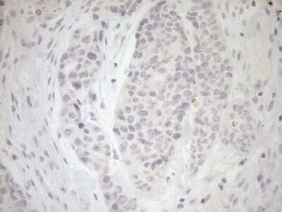 Immunohistochemistry: Myozenin 1 Antibody (OTI4C2) [NBP2-46071]