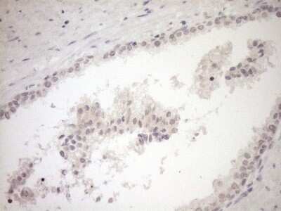 Immunohistochemistry: Myozenin 1 Antibody (OTI4C2) [NBP2-46071]