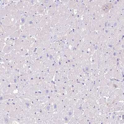 Immunohistochemistry-Paraffin: Myozenin 1 Antibody [NBP1-85439]