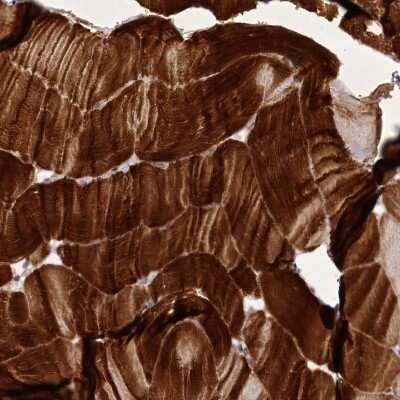 Immunohistochemistry-Paraffin: Myozenin 1 Antibody [NBP1-85439]