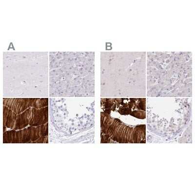 Immunohistochemistry-Paraffin: Myozenin 1 Antibody [NBP1-85439]