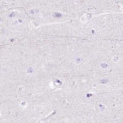 Immunohistochemistry-Paraffin: Myozenin 1 Antibody [NBP1-85439]