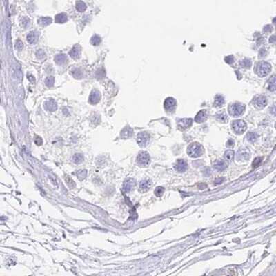 Immunohistochemistry-Paraffin: Myozenin 1 Antibody [NBP1-85439]