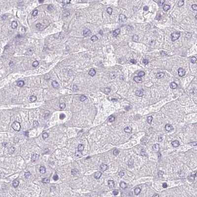 Immunohistochemistry-Paraffin: Myozenin 1 Antibody [NBP1-85439]