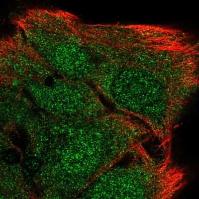 Immunocytochemistry/ Immunofluorescence: Myozenin 2 Antibody [NBP1-88259]