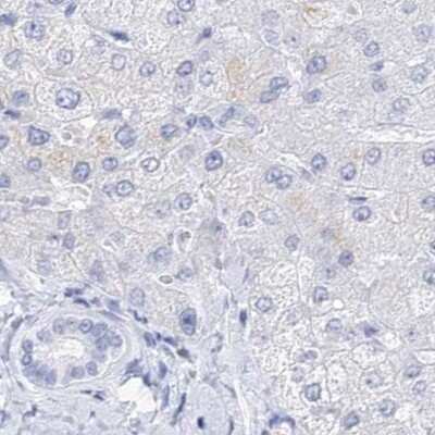 Immunohistochemistry-Paraffin: Myozenin 2 Antibody [NBP1-88259]