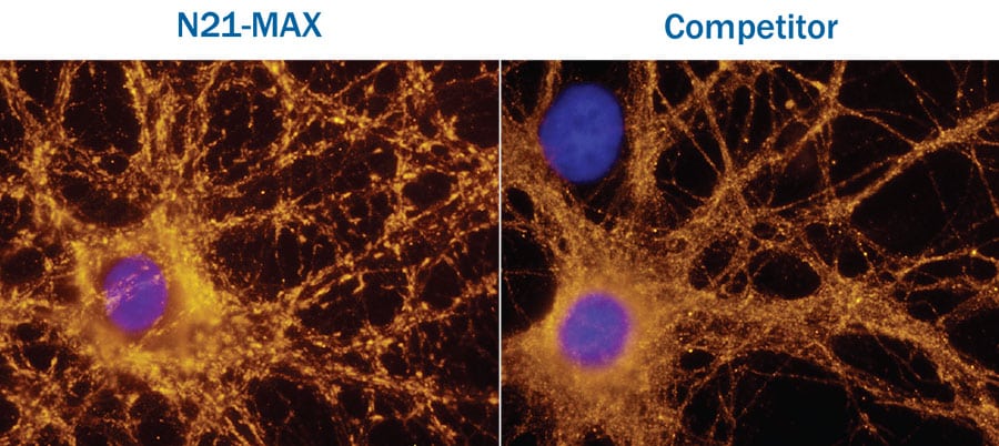 Increased Synaptic Puncta and Neurite Outgrowth of Primary Neurons Cultured in N21-MAX.