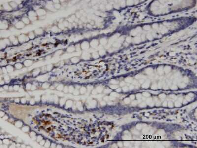 Immunohistochemistry-Paraffin: N-Acetylglucosaminyltransferase V/MGAT5 Antibody (3E9) [H00004249-M09]