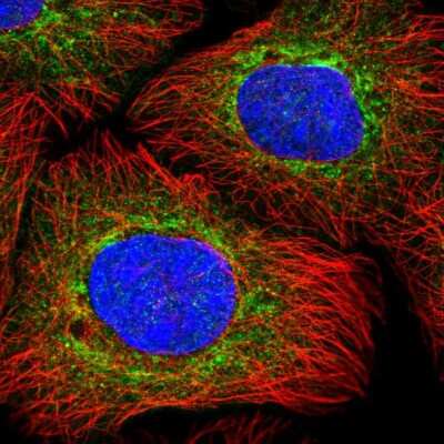 Immunocytochemistry/ Immunofluorescence: N-Acetylmannosamine Kinase/GNE Antibody [NBP1-81621]