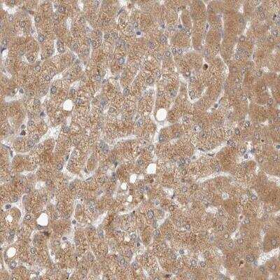 Immunohistochemistry-Paraffin: N-Acetylmannosamine Kinase/GNE Antibody [NBP1-81621]