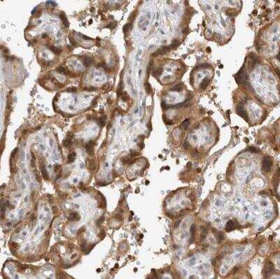 Immunohistochemistry-Paraffin: N-Acetylmannosamine Kinase/GNE Antibody [NBP1-81621]