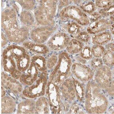 Immunohistochemistry-Paraffin: N-Acetylmannosamine Kinase/GNE Antibody [NBP1-81621]