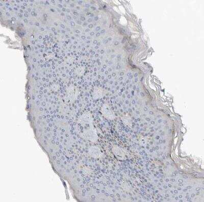 Immunohistochemistry-Paraffin: N-Acetylmannosamine Kinase/GNE Antibody [NBP1-81621]