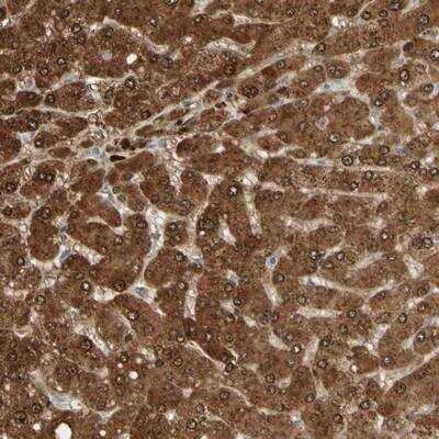 Immunohistochemistry-Paraffin: N-Acetylmannosamine Kinase/GNE Antibody [NBP1-81622]