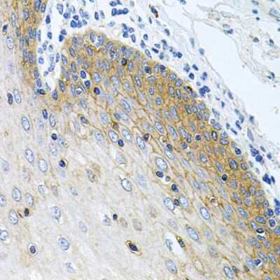 Immunohistochemistry-Paraffin: N-Acetylmannosamine Kinase/GNE Antibody - BSA Free [NBP2-94770]