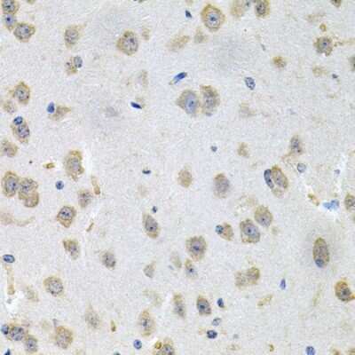 Immunohistochemistry-Paraffin: N-Acetylmannosamine Kinase/GNE Antibody - BSA Free [NBP2-94770]