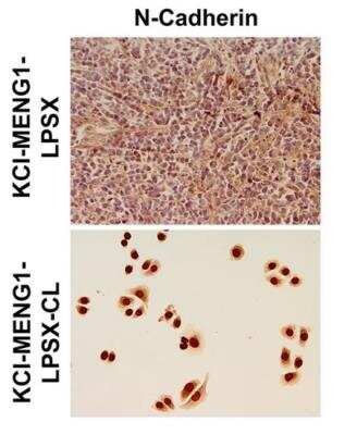 Immunocytochemistry: N-Cadherin Antibody (13A9) [NBP1-48309]