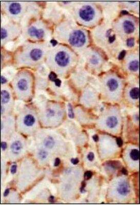 Immunohistochemistry: N-Cadherin Antibody (13A9) [NBP1-48309]