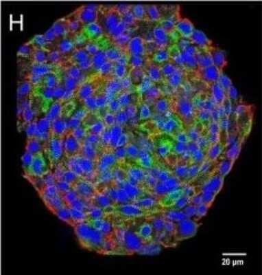 Immunohistochemistry: N-Cadherin Antibody (13A9) [NBP1-48309]