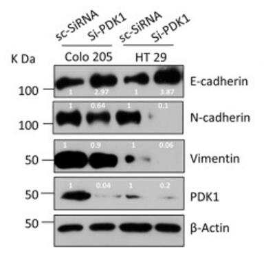 Western Blot: N-Cadherin Antibody (13A9) [NBP1-48309]