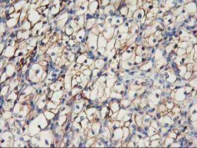 Immunohistochemistry-Paraffin: N-Cadherin Antibody (OTI2G7) [NBP2-01498]