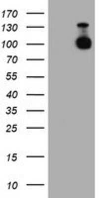 Western Blot: N-Cadherin Antibody (OTI2G7) [NBP2-01498]