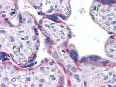 Immunohistochemistry-Paraffin: N-Cadherin Antibody (5D5) - BSA Free [NBP1-51612]