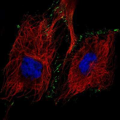 Immunocytochemistry/ Immunofluorescence: N-Cadherin Antibody (CL3716) [NBP2-61632]