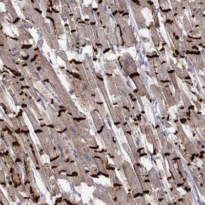 Immunohistochemistry-Paraffin: N-Cadherin Antibody (CL3716) [NBP2-61632]