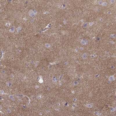 Immunohistochemistry-Paraffin: N-Cadherin Antibody (CL3716) [NBP2-61632]
