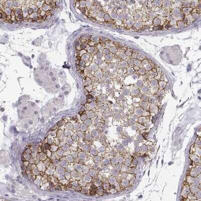 Immunohistochemistry-Paraffin: N-Cadherin Antibody (CL3716) [NBP2-61632]