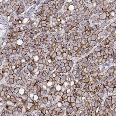 Immunohistochemistry-Paraffin: N-Cadherin Antibody (CL3716) [NBP2-61632]