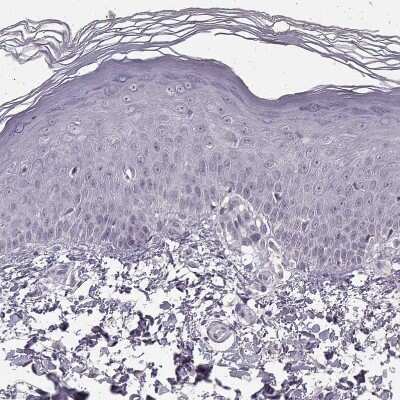Immunohistochemistry-Paraffin: N-Cadherin Antibody (CL3716) [NBP2-61632]