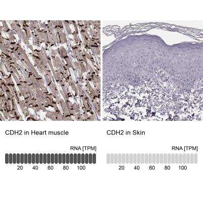 Immunohistochemistry-Paraffin: N-Cadherin Antibody (CL3716) [NBP2-61632]