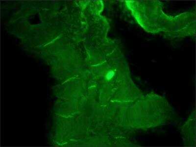Immunohistochemistry: N-Cadherin Antibody (GC-4) [NBP2-21805]